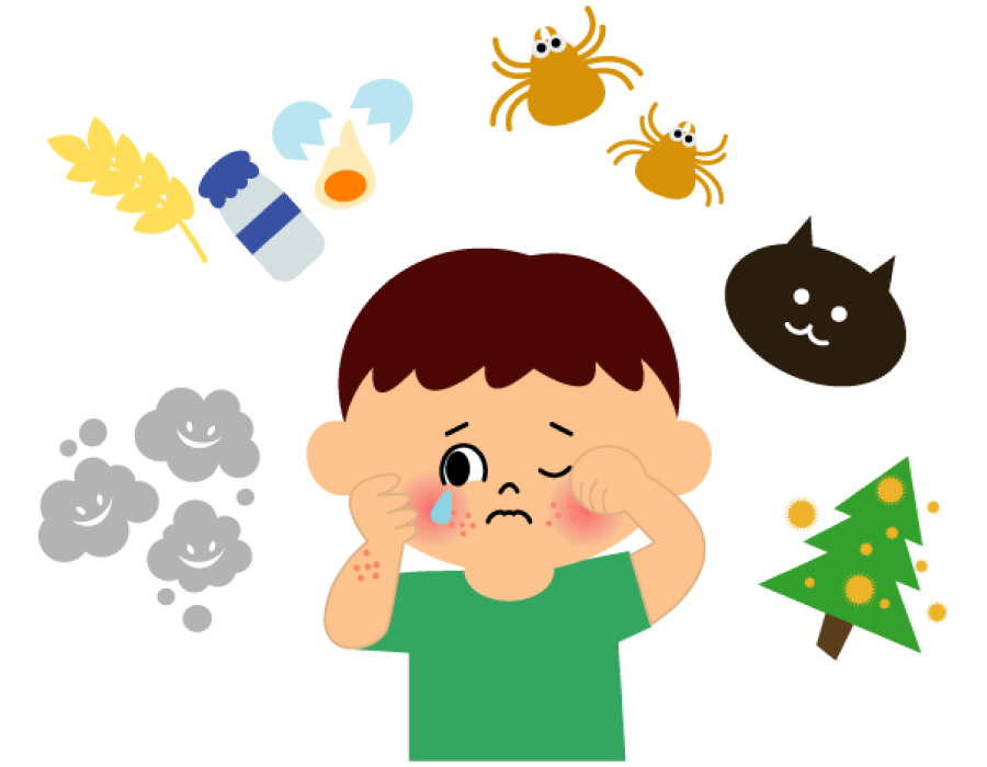 ［子育て講座］食物アレルギー